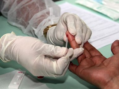 Brasil tem aumento de 27,9% no número de casos de sífilis