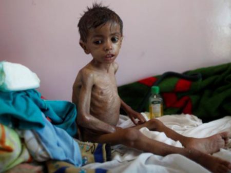 Organizações humanitárias: ‘EUA é cúmplice de massacre no Iêmen’