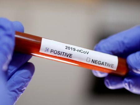 Brasil registra 4 mortes por coronavírus e 529 casos confirmados