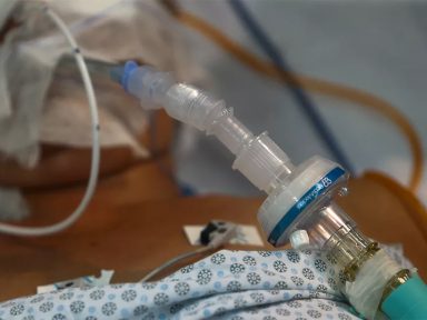 Mais de 1.300 municípios podem ficar sem medicamentos para intubação, alerta CNM