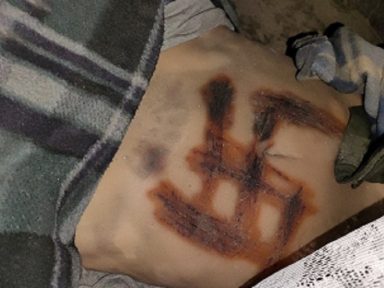 Tortura em Mariupol: nazistas ucranianos tatuam suástica na barriga de uma mulher e a assassinam