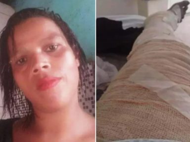 Sem dinheiro para gás de cozinha, jovem morre após acidente grave com álcool