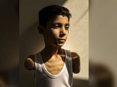 ‘Como vou te abraçar?’: foto do ano mostra menino de Gaza que perdeu os braços em ataque israelense