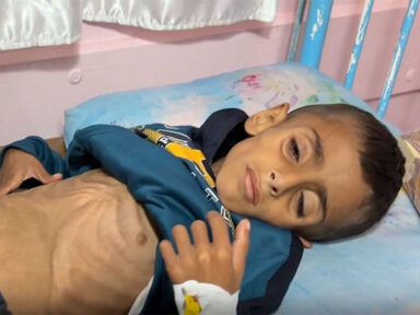 Mais de 9.000 crianças palestinas de Gaza foram internadas com desnutrição aguda, alerta Unicef