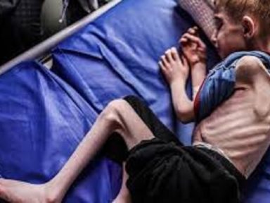 1.000 rabinos condenam fome imposta por Netanyahu aos palestinos de Gaza