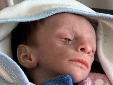 21 crianças palestinas morrem de fome em Gaza pelo bloqueio imposto por Israel