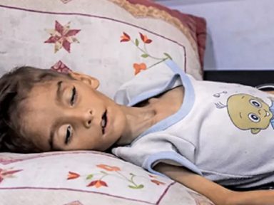 Fome catastrófica traz risco de morte iminente a 641.000 palestinos, denuncia ONU