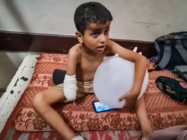 A guerra é um horror, não desvie o olhar: as crianças de Gaza amputadas sem anestesia