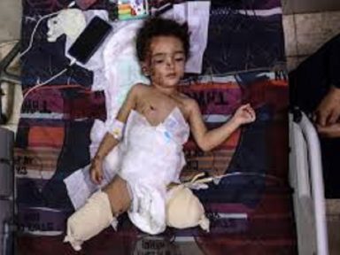 General israelense defende matança de crianças palestinas em Gaza: “É necessário”