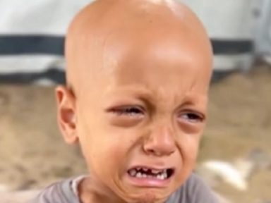 Bebê filmado chorando com fome morre da inanição imposta por Israel